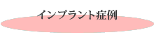 �C���v�����g�Ǘ�